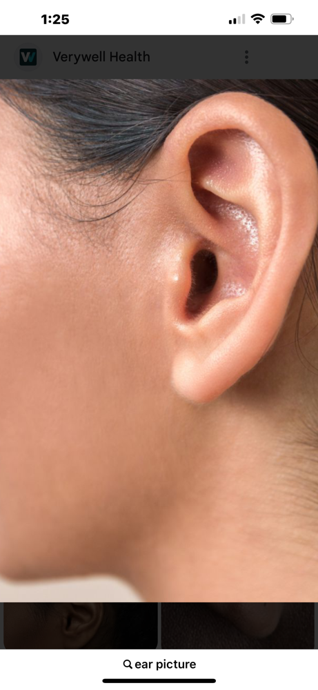 Ear Wax