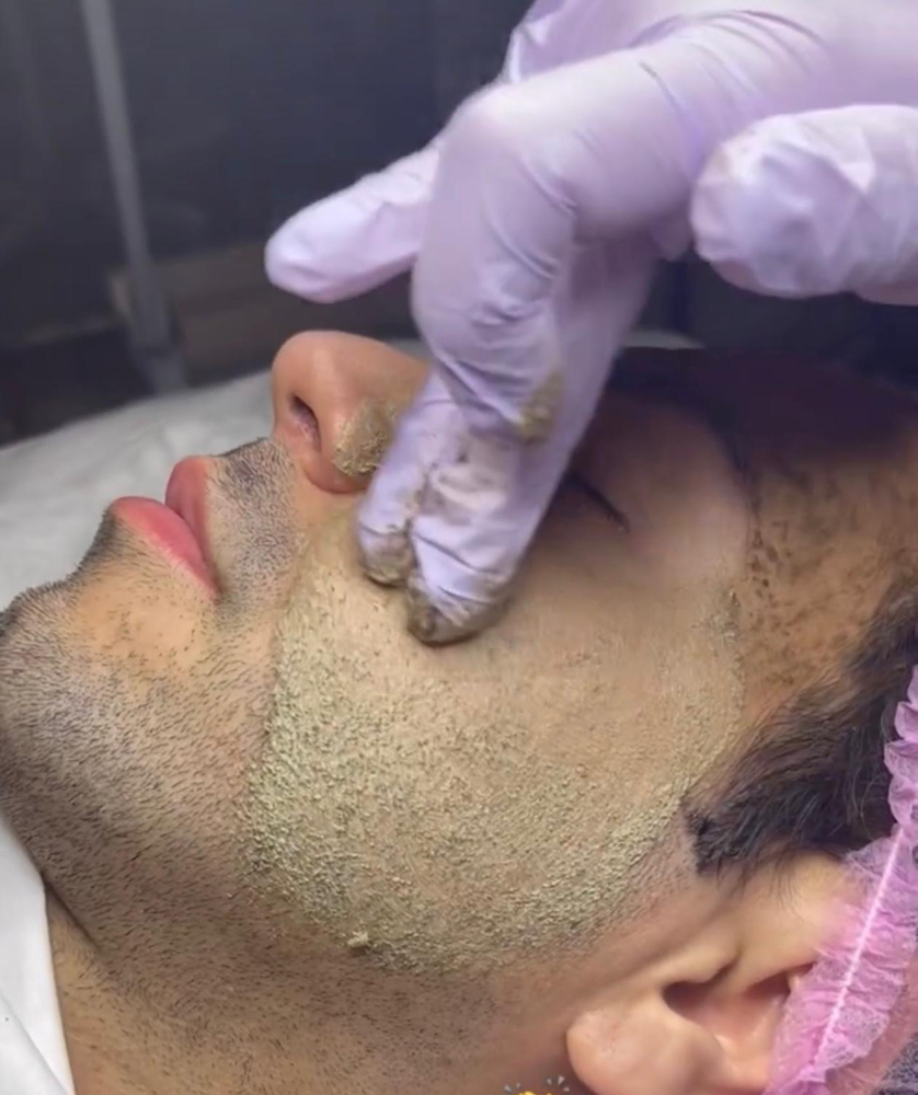 Herbal Peeling