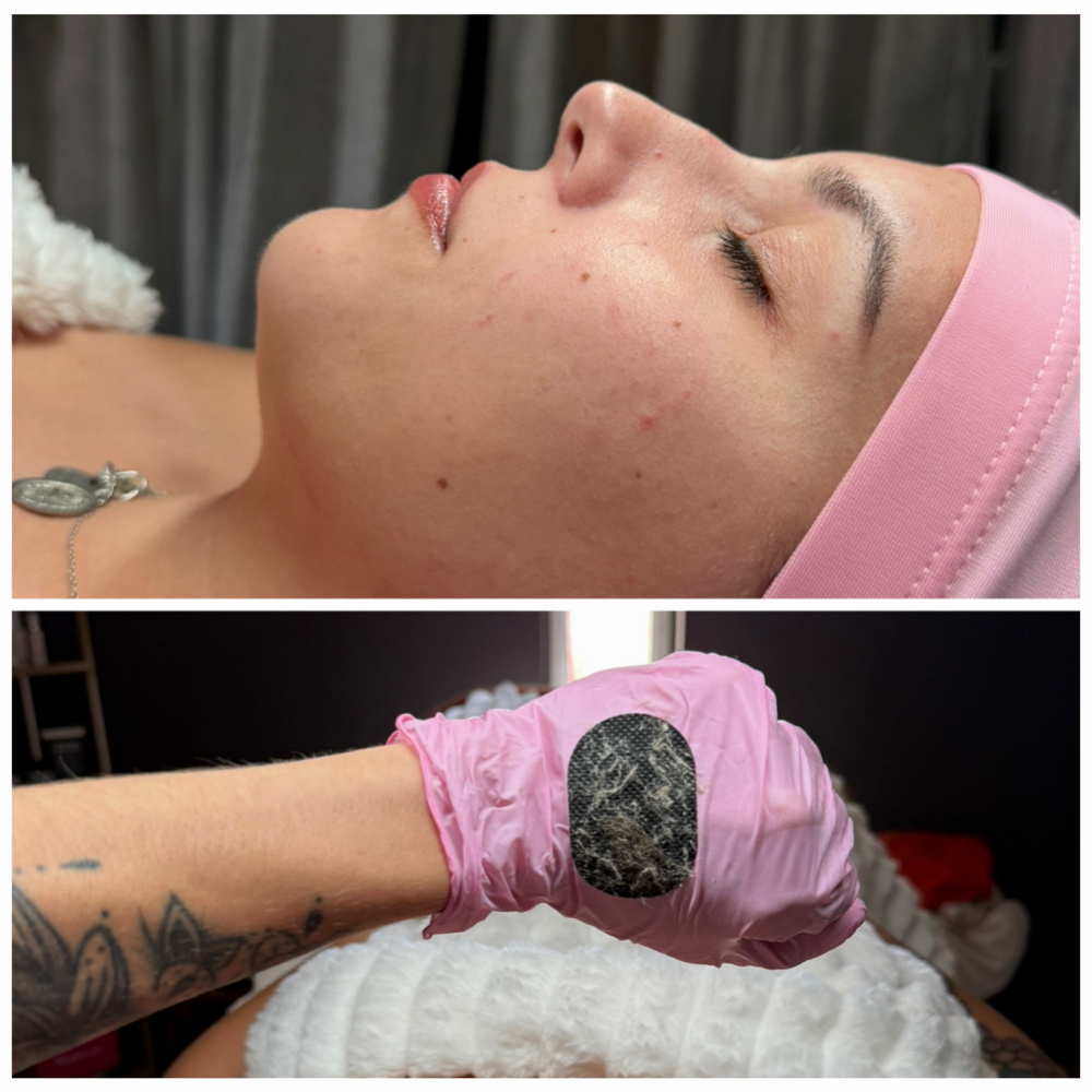 Dermaplane Facial at Blush & Bloom in Claremore, OK