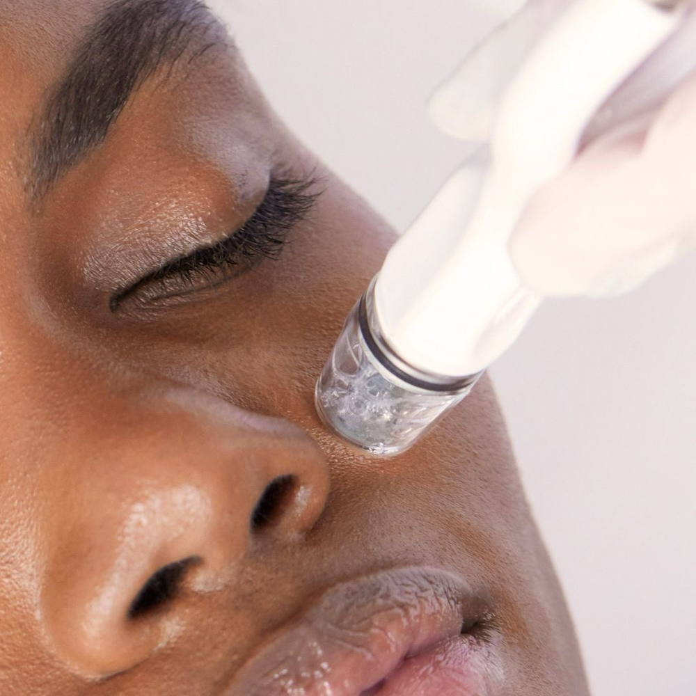 Hydro Facial