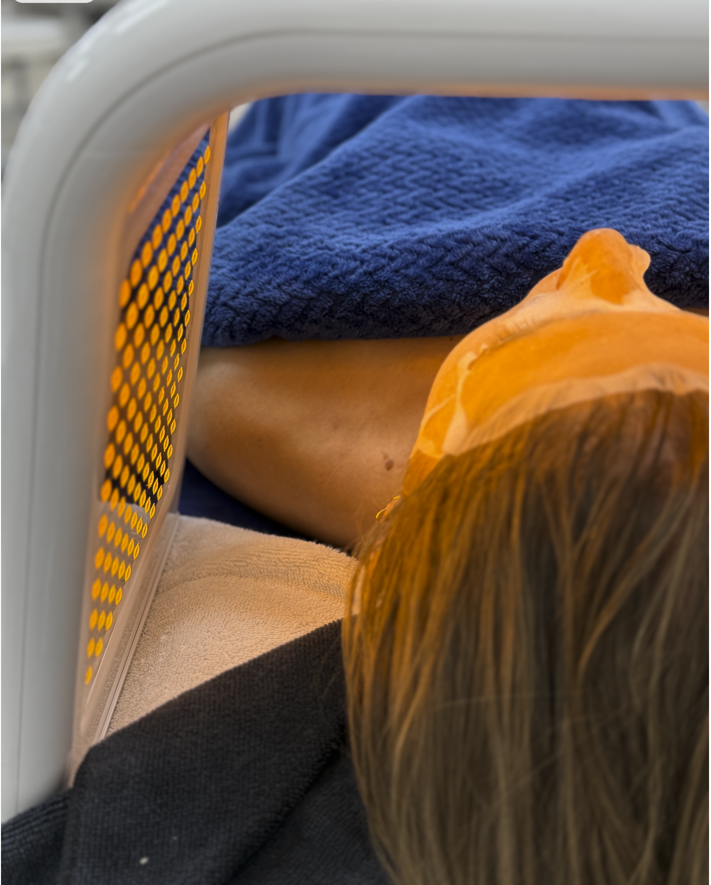 Microneedling Facial