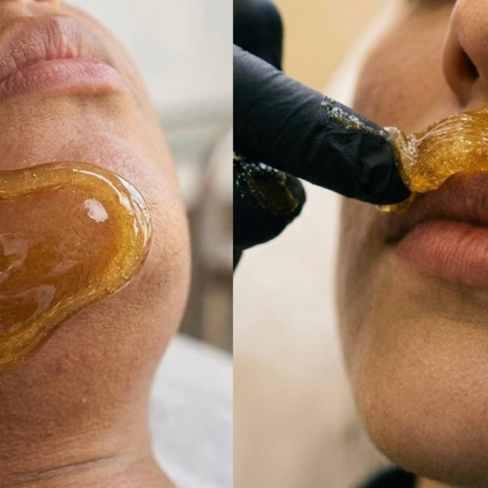 Lip + Chin Bundle at Bare Sugar Beauty in Montclair, CA
