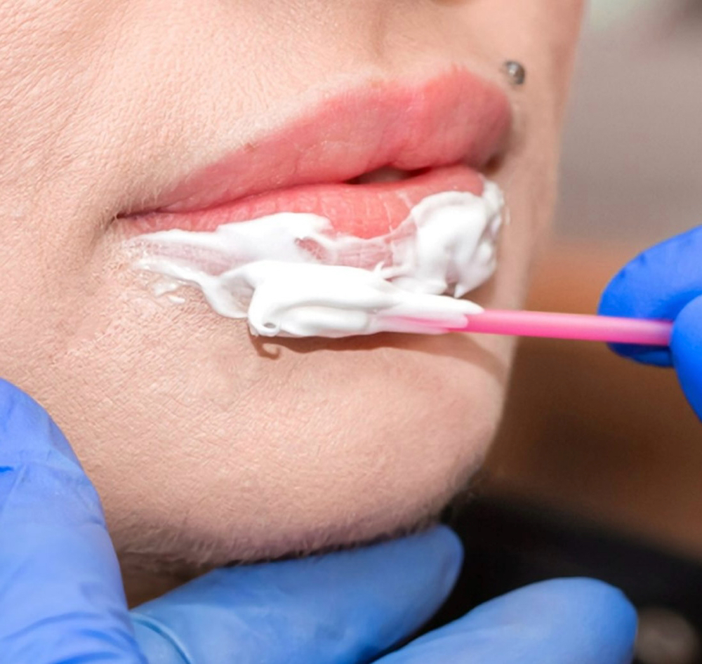 Lip Filler Numbing Cream