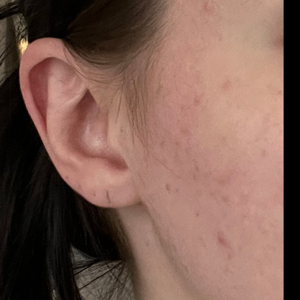Nose and Ear Wax