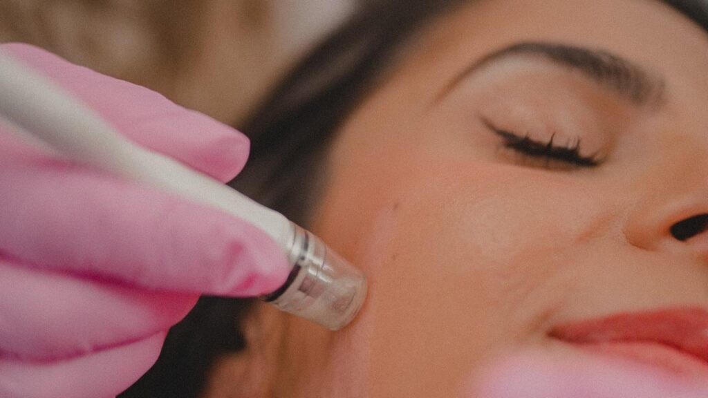 Microdermabrasion Facial