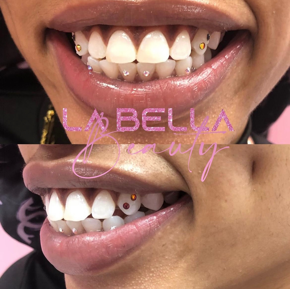 4 Tooth Crsytal Tooth Gems