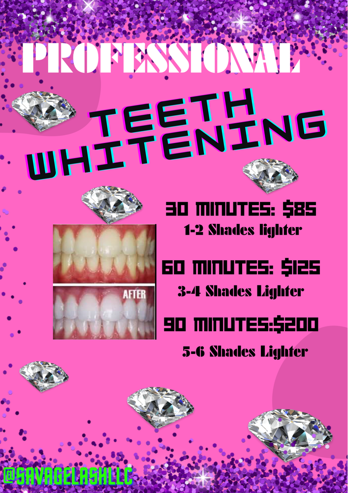 Professional Teeth Whitening 30Min