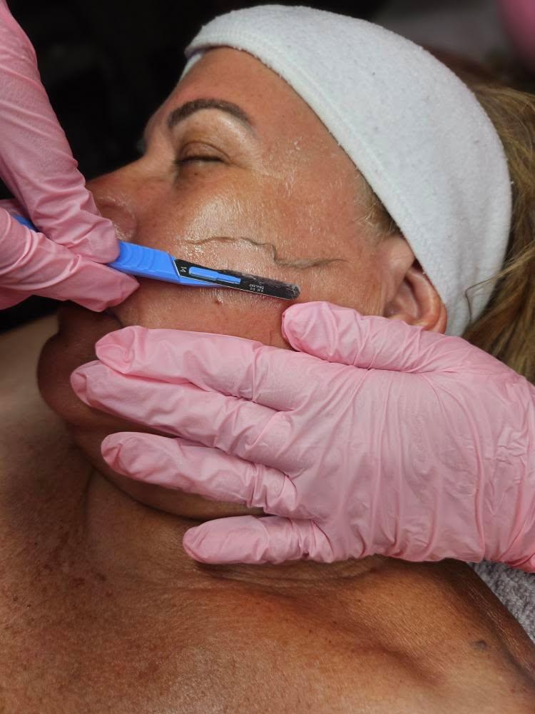 Dermaplaning Facial