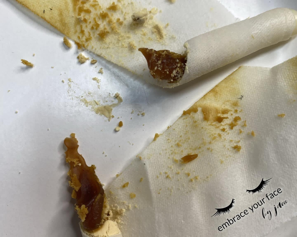 Ear Candling