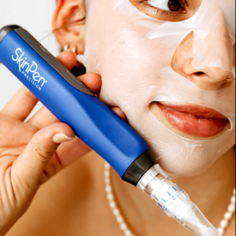 SkinPen Microneedling