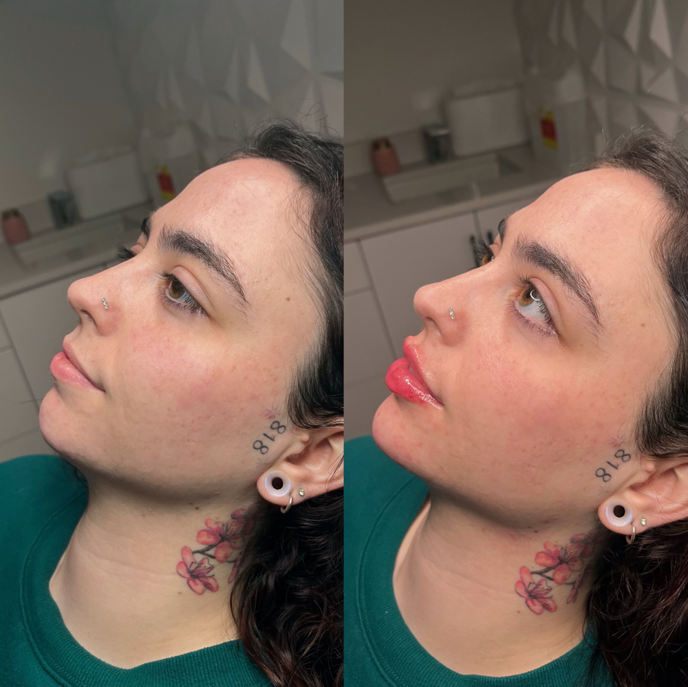 Facial Balance