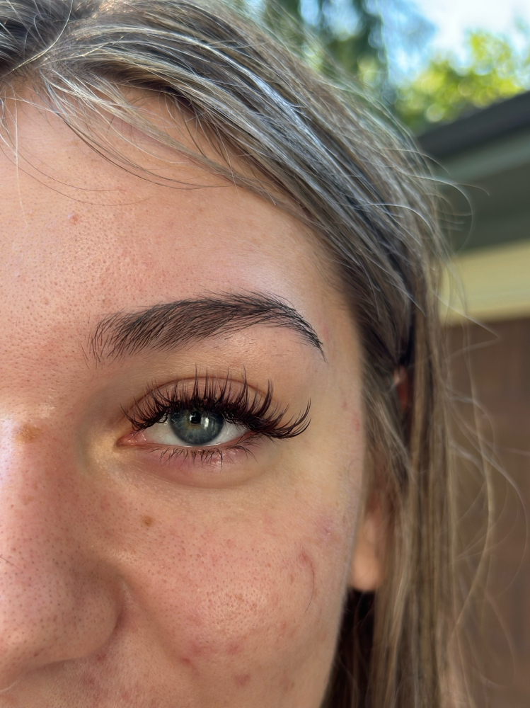 Mega Classic | Wet 3 Week Fill at Alo Aesthetics in Wichita, KS