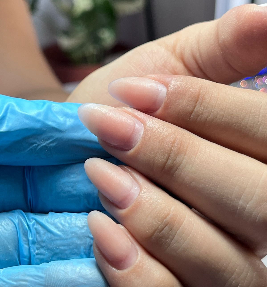 Acrylic Fill (only Our Clients )