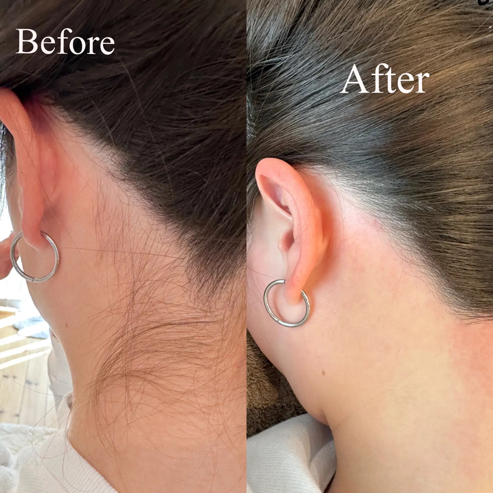 Neck at Carrie Anne’s Beauty Lab in Columbus, OH