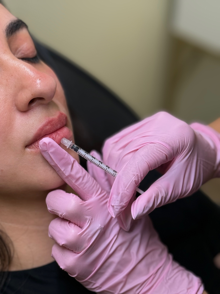 Half Syringe & Botox Black Friday