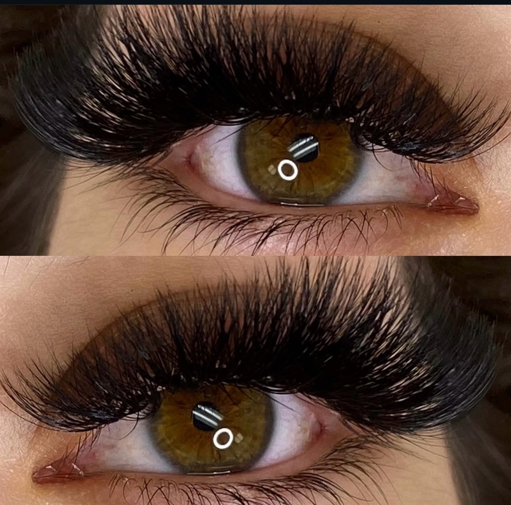 Mega Fill at Aura aesthetics in Red Bluff, CA