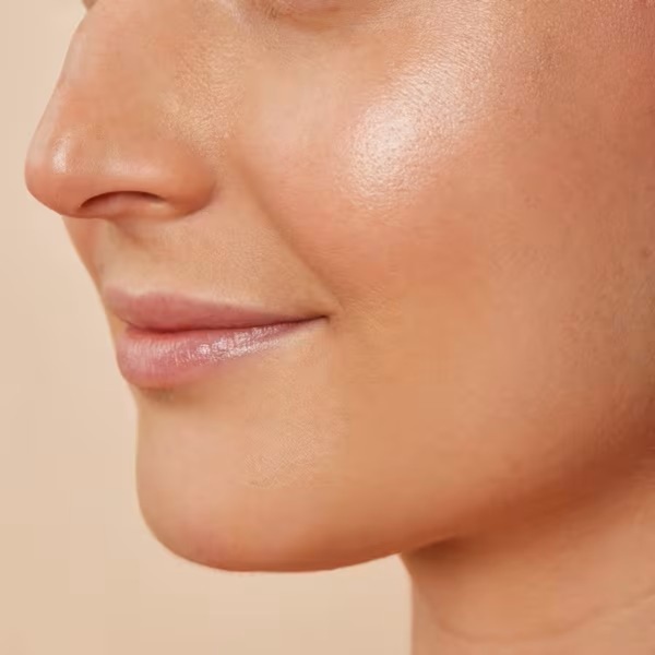 Fillers at Michelle Beauty Suite in Newark, NJ
