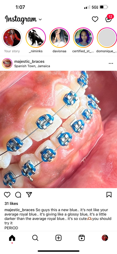 Cosmetic Tooth Gems, TOP Only.