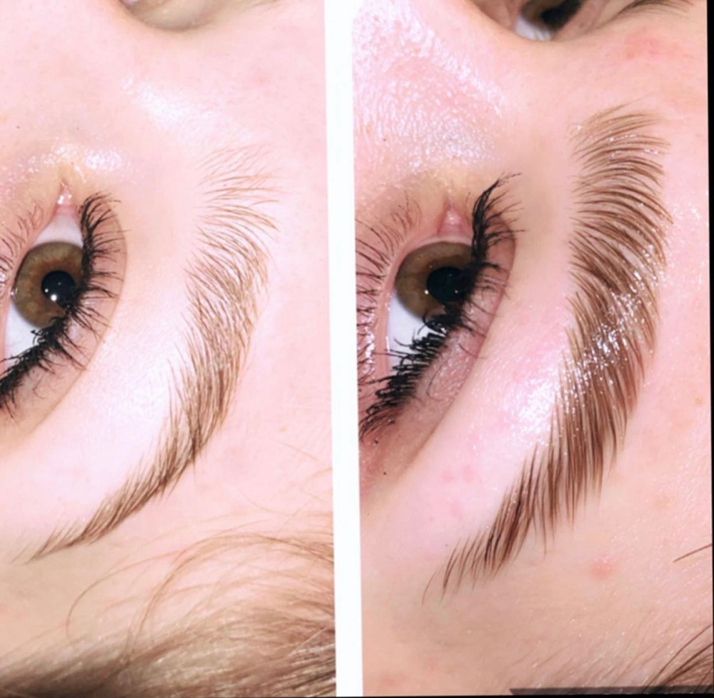 Brow Lamination