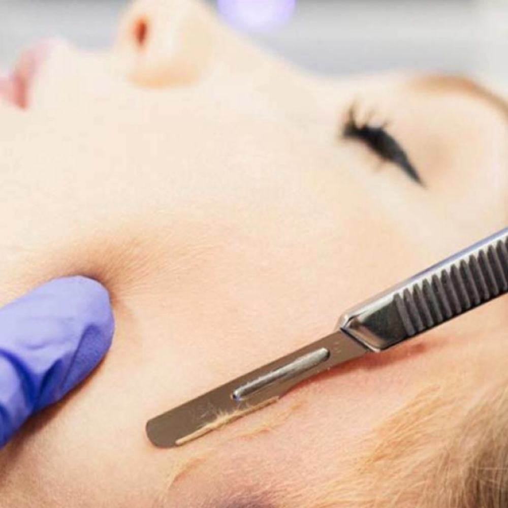 Dermaplane only at Arosa Aesthetics in Reno, NV