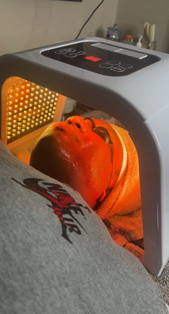 Acne Facial Treatment