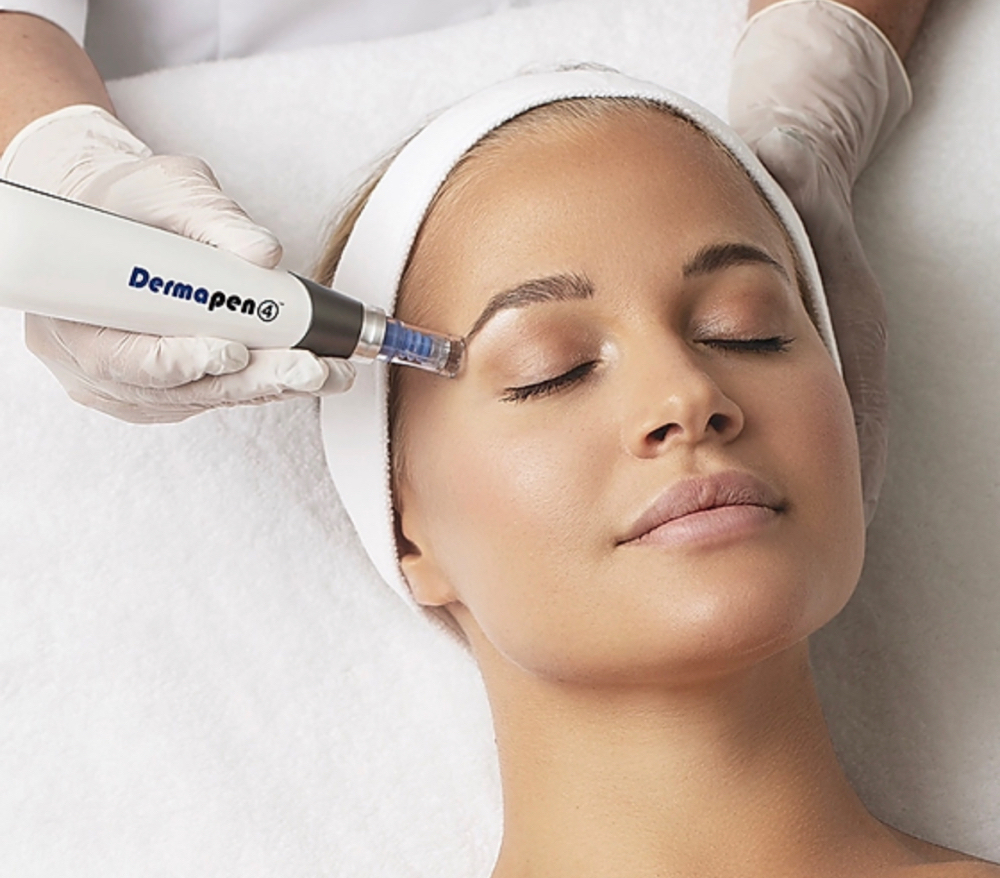 6 Microneedle Treatments Package