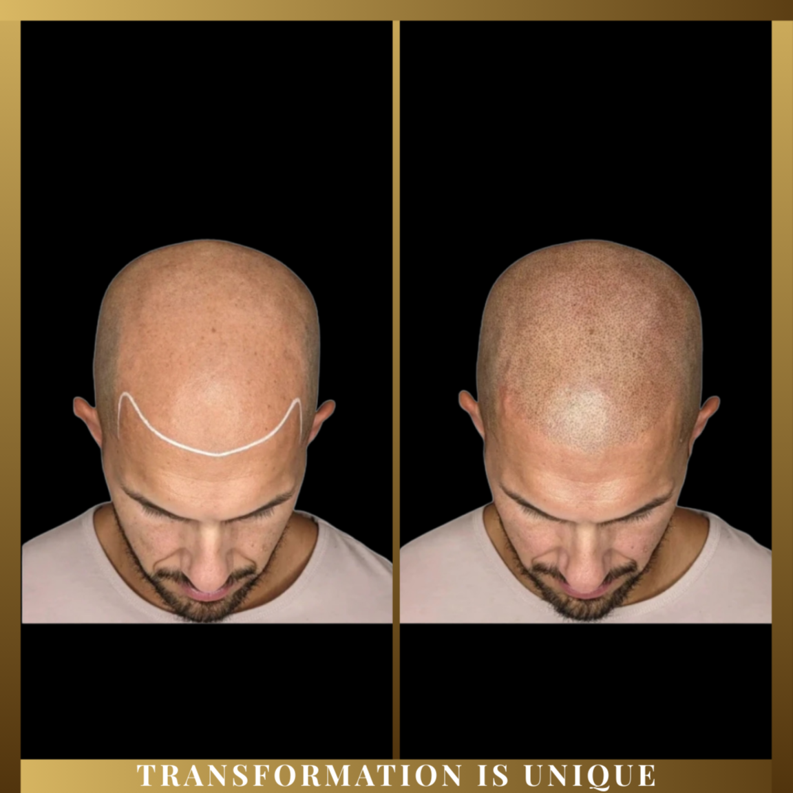 SMP Full Transformation