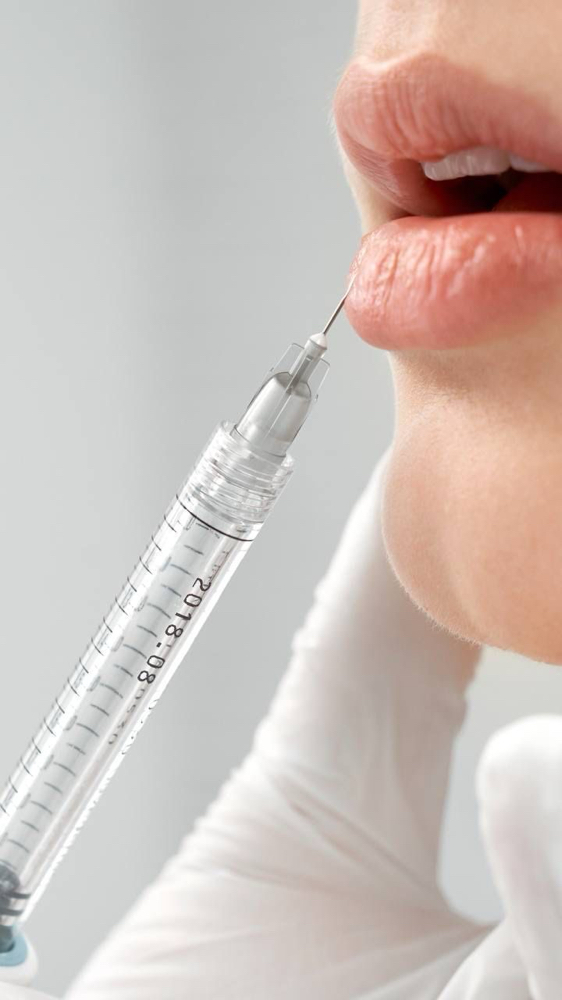 Lip Filler- Full Syringe