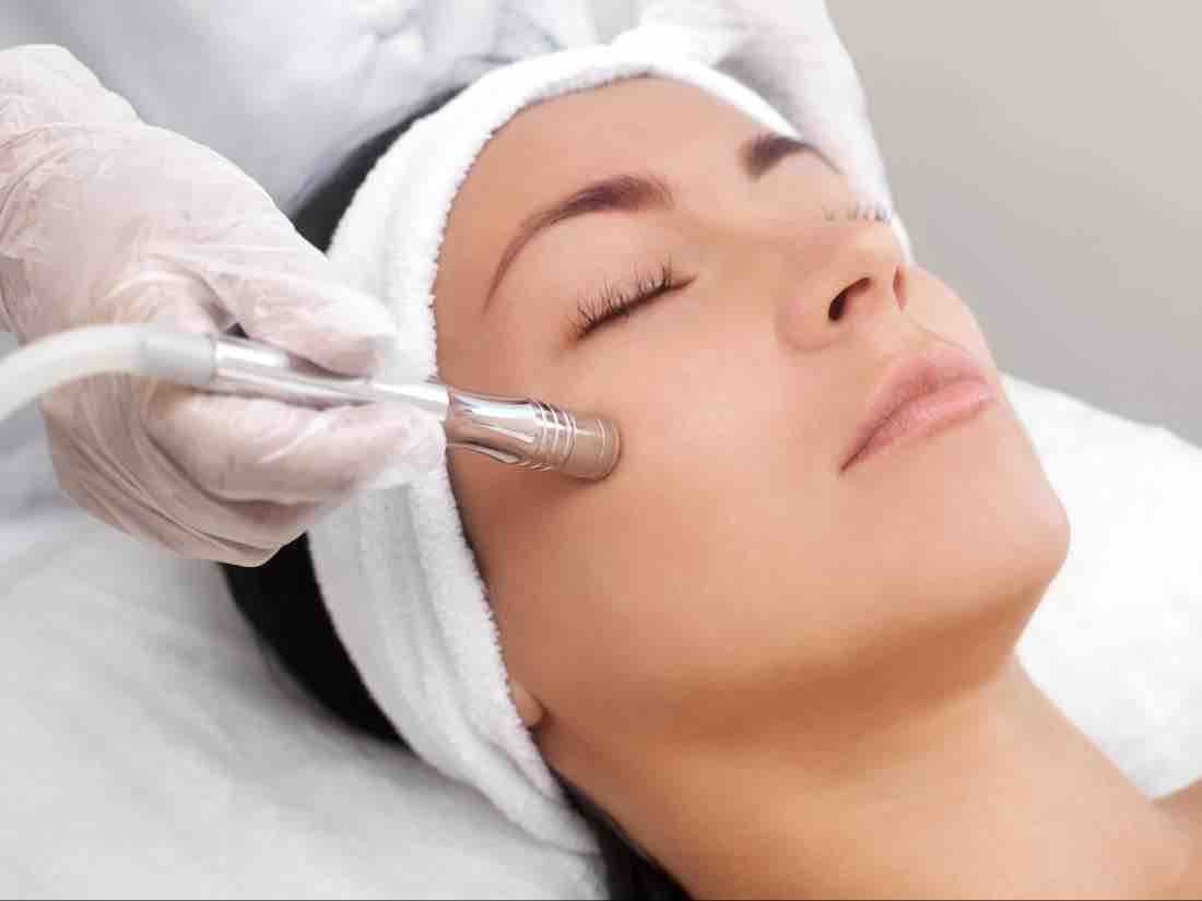 Microdermabrasion