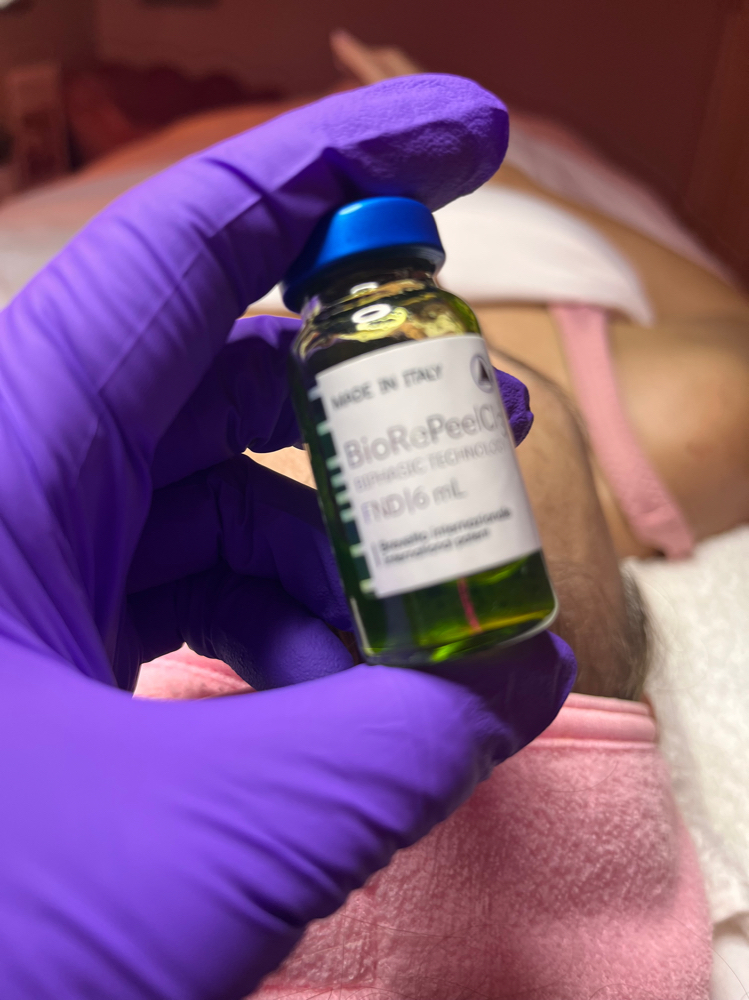 BioRe Peel