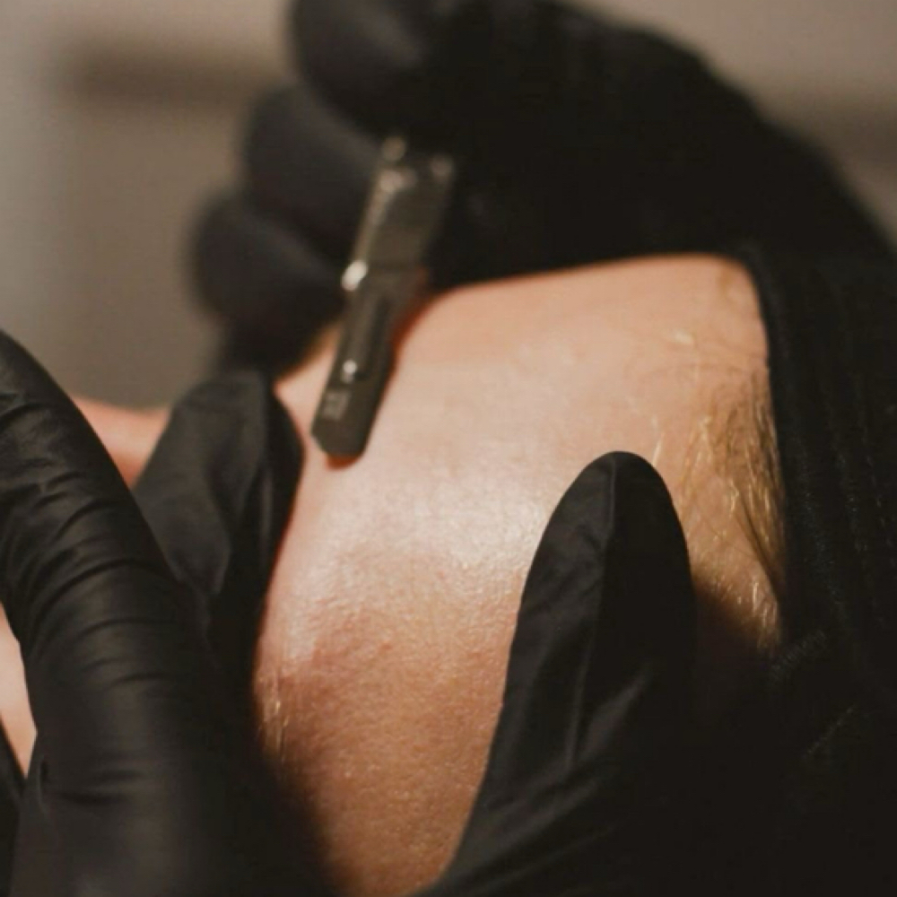 Dermaplane Add-On at Boites Beauty Lounge in FLORENCE, SC