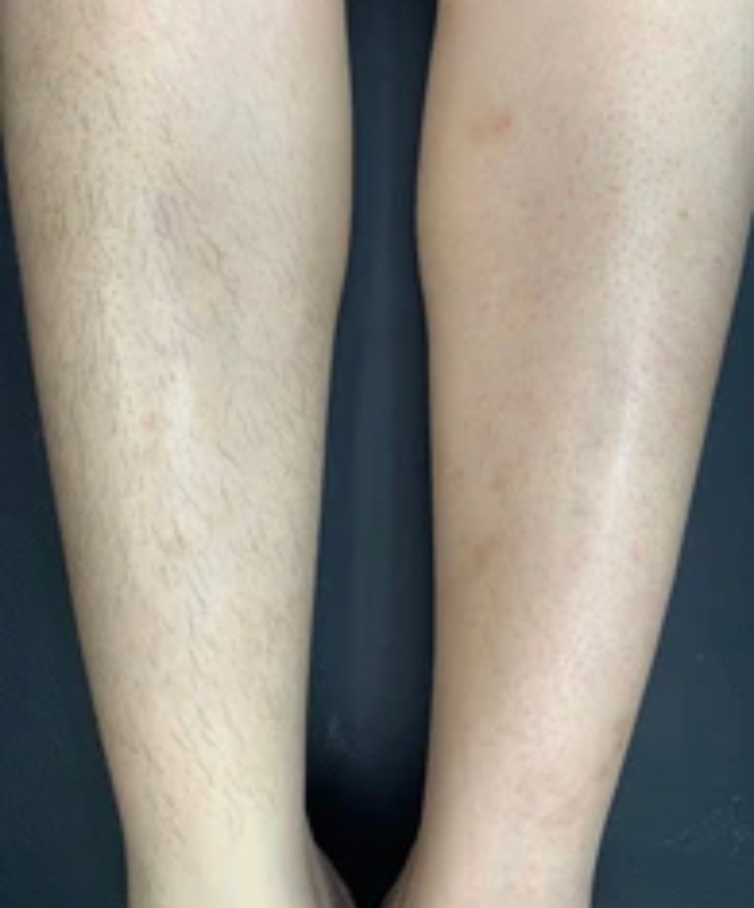 Lower Leg Wax