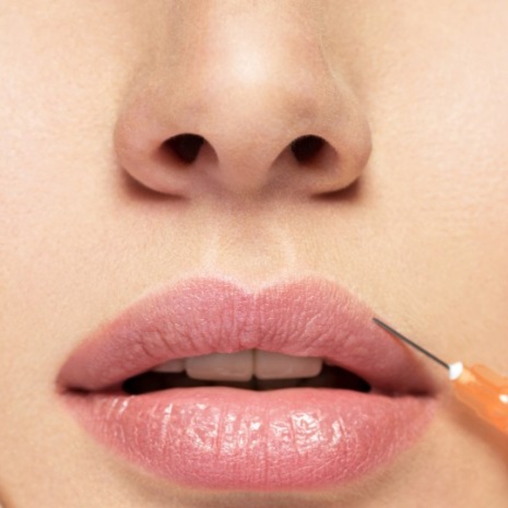 Lip Flip at Altamaha Aesthetics & Wellness in Reidsville, GA