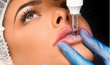 Hyaluronic Lip Fillers 1ML