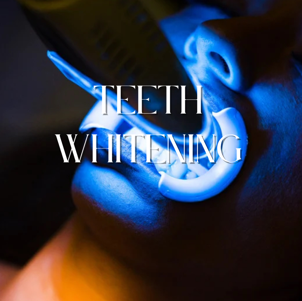 Teeth Whitening 60 mins
