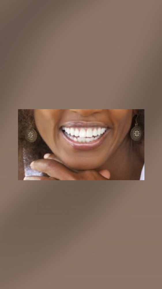 Teeth Whitening 60 mins