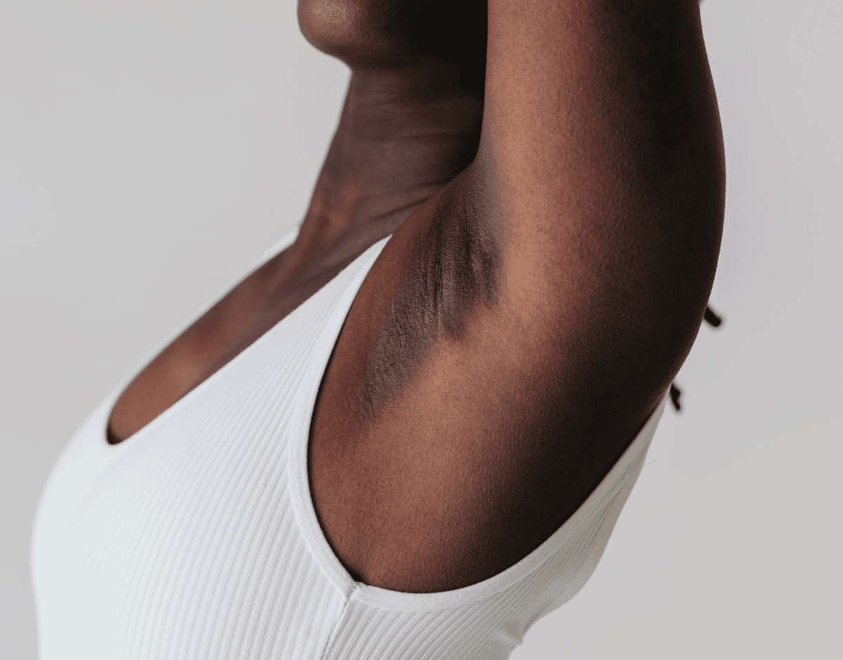 Underarm (Add-on)