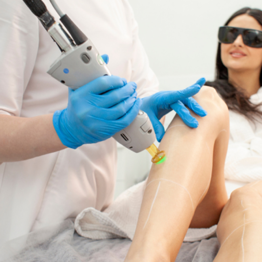 Laser Hair Reduction- Full Legs at Joy to Beauty in Jupiter, FL