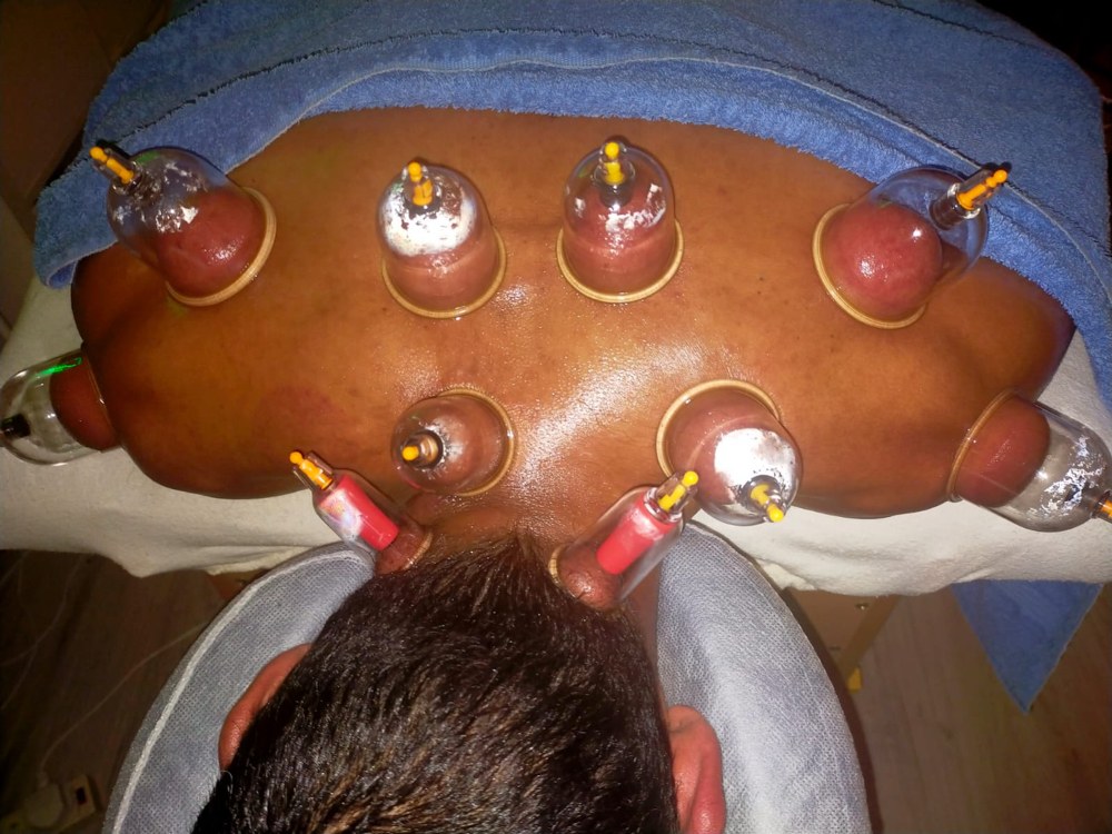 1 Hour Cupping Massage