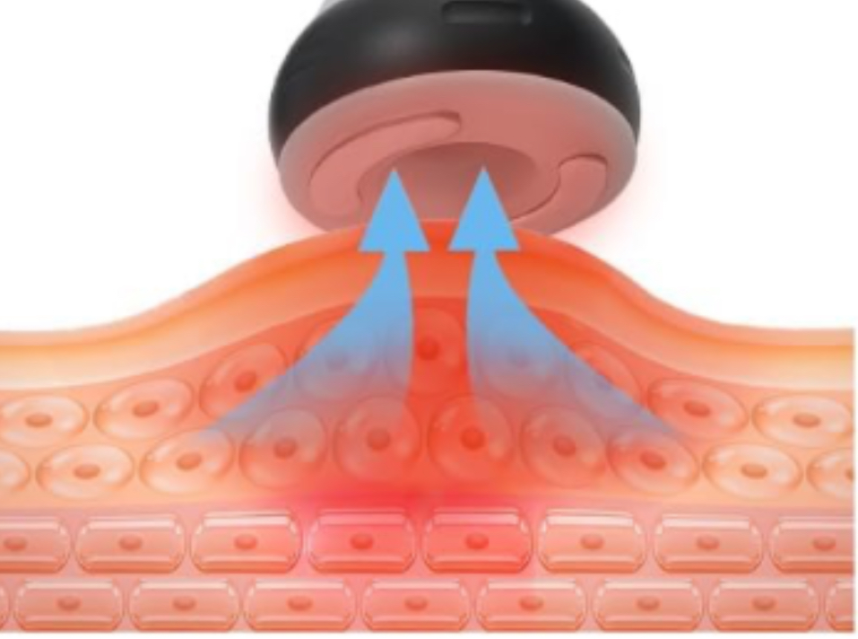 Bipolar Vacuum