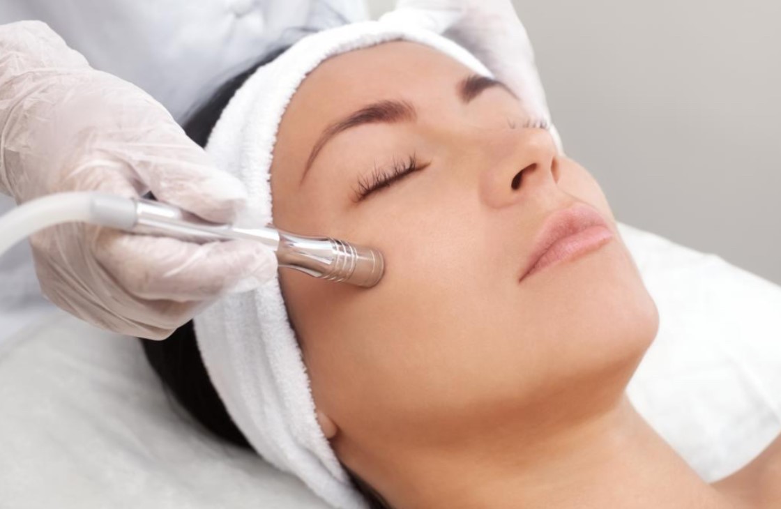 Microdermabrasion & Chemical Peel