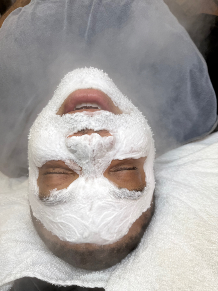 Healing Acne Facial