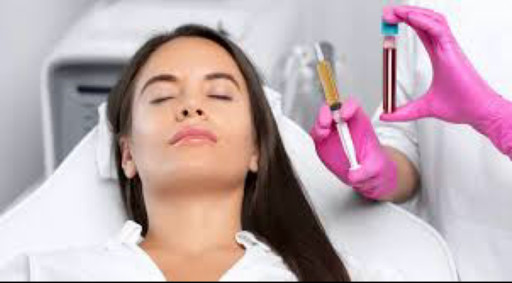 Microneedling With PRP