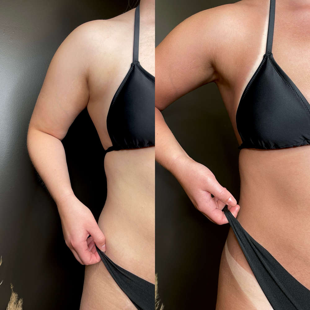 Spray Tan