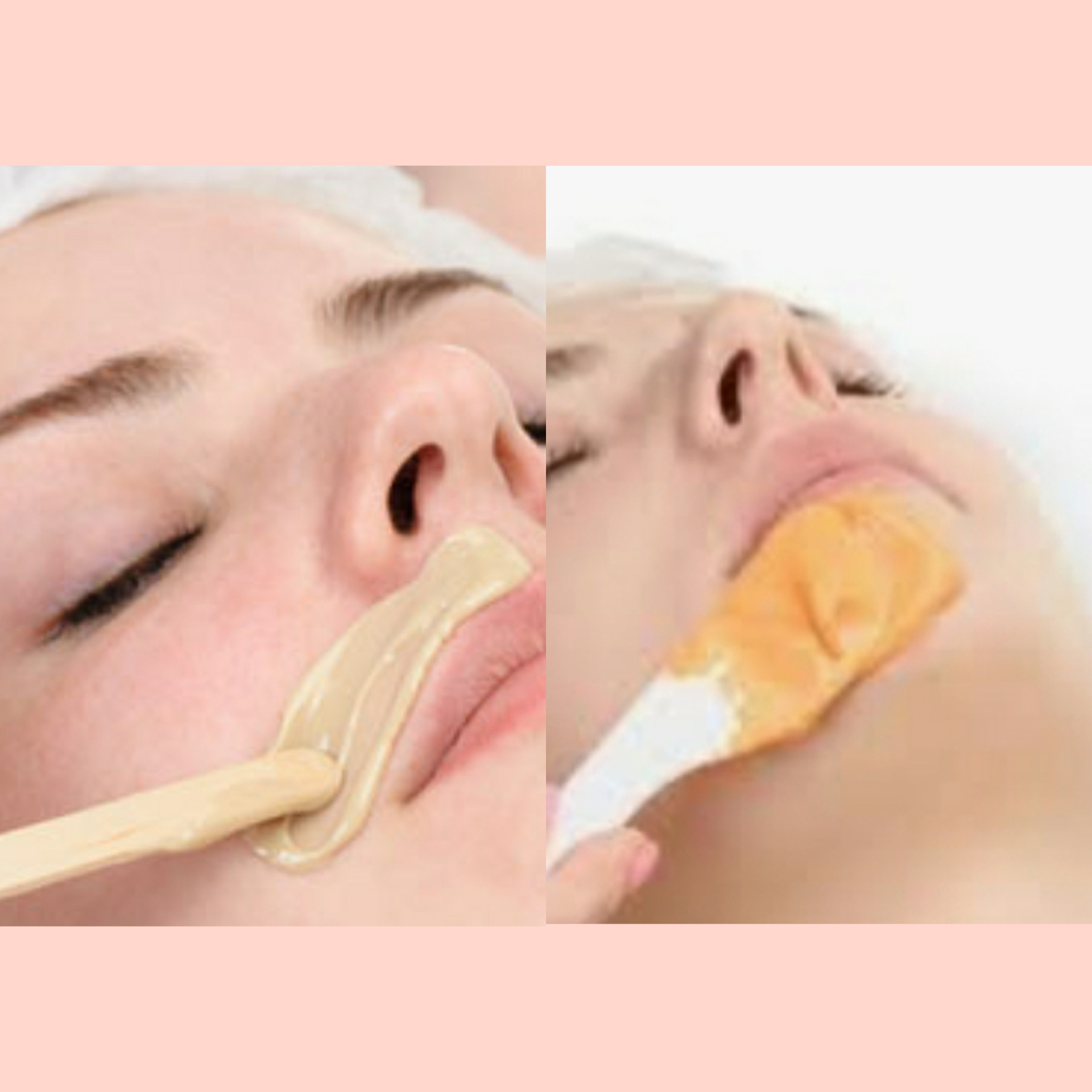 Waxing - Lip and Chin