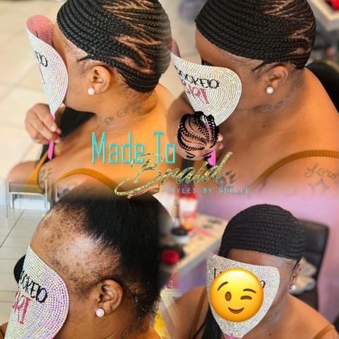 Hair Loss Lemonade Braids