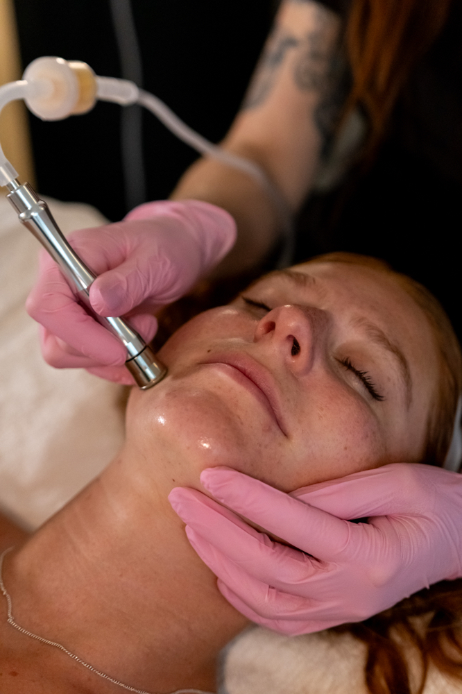 Diamond Microdermabrasion Facial