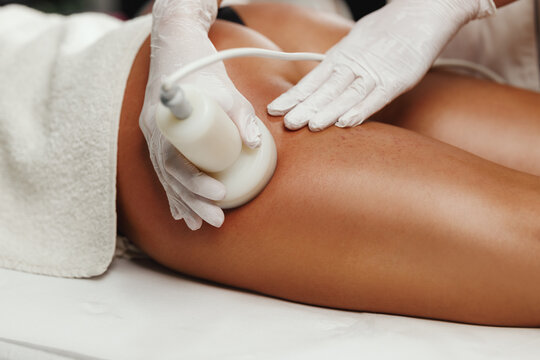 RF Body Contour 6 Session Package