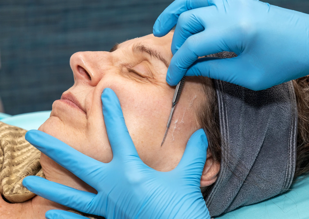 Dermaplaning Facial
