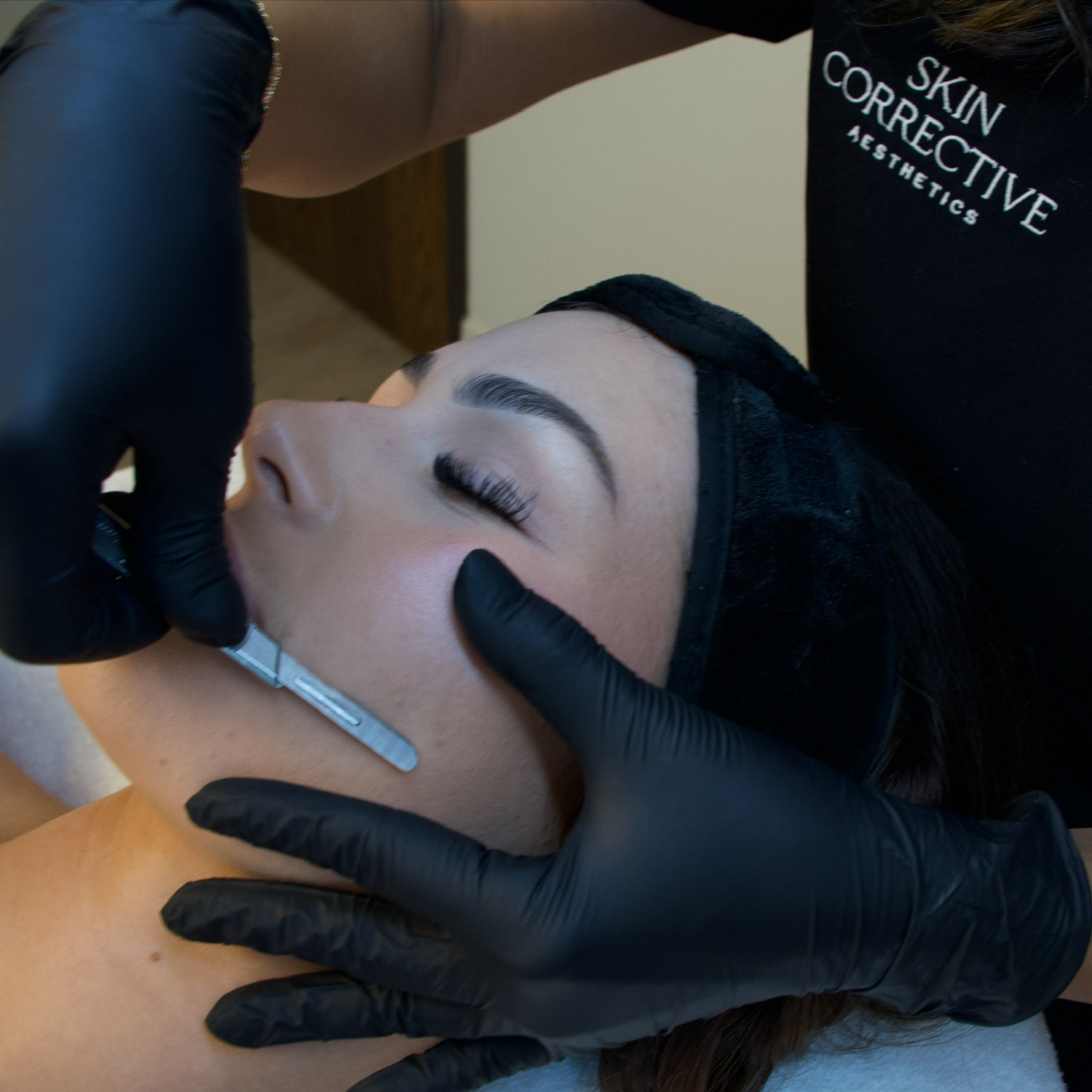 Radiant Skin Dermaplane Facial at Skin Corrective Aesthetics in Dallas, TX